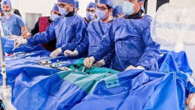 إنجاز طبي بمستشفى العاصمة الإدارية: قسطرة مخية ناجحة لطفلة عمرها 6 أشهر