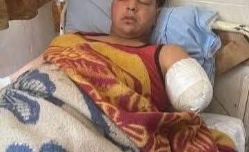 أولى تصريحات ضحية هجوم والتهام النمر على عامل بسيرك كوتة بطنطا 1 أولى تصريحات ضحية هجوم والتهام النمر على عامل بسيرك كوتة بطنطا