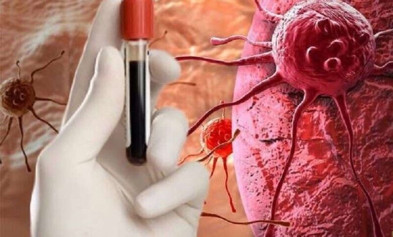 علامات غير واضحة للسرطان 1 علامات غير واضحة للسرطان
