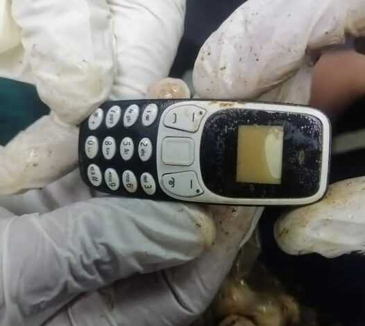 استخراج هاتف محمول من معدة مريض بمستشفى الأزهر الجامعي بأسيوط 1 استخراج هاتف محمول من معدة مريض بمستشفى الأزهر الجامعي بأسيوط
