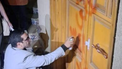 الصحة: إغلاق عيادة للتجميل بالشيخ زايد للعمل بدون ترخيص