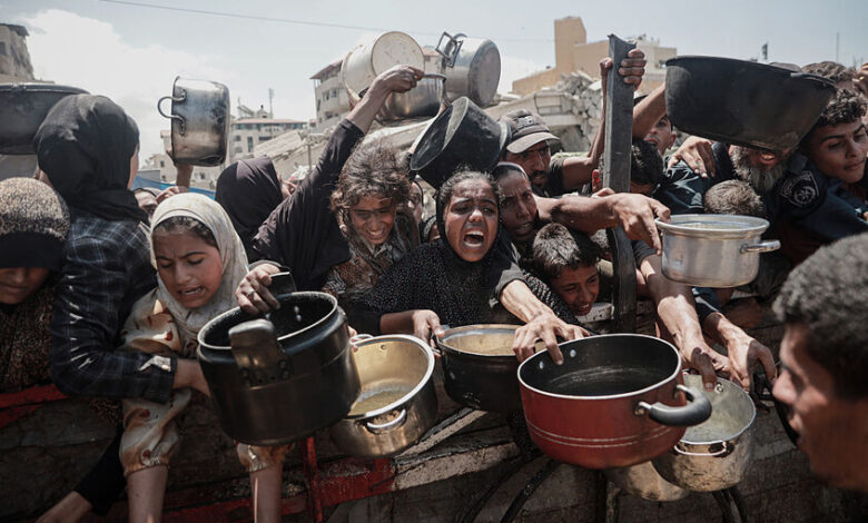 صحة غزة: بسبب نتيجة سوء التغذية وفاة 3 فلسطينيين بينهم طفلان خلال 24 ساعة 1 صحة غزة: بسبب نتيجة سوء التغذية وفاة 3 فلسطينيين بينهم طفلان خلال 24 ساعة