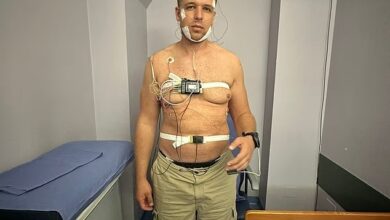  شاب بريطاني لم يغمض له جفن منذ عامين في حالة طبية مستعصية