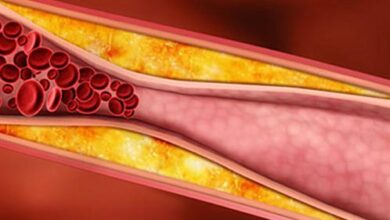 حسام موافي يوجه نصائح مهمة : 4 أنواع من الخضراوات لا يخلو منها بيتك  