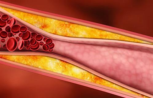 حسام موافي يوجه نصائح مهمة : 4 أنواع من الخضراوات لا يخلو منها بيتك  